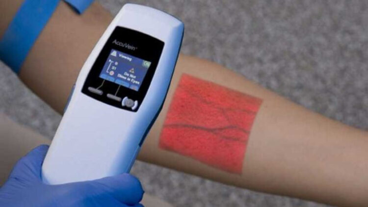 Who can Benefit From a Vein Finder