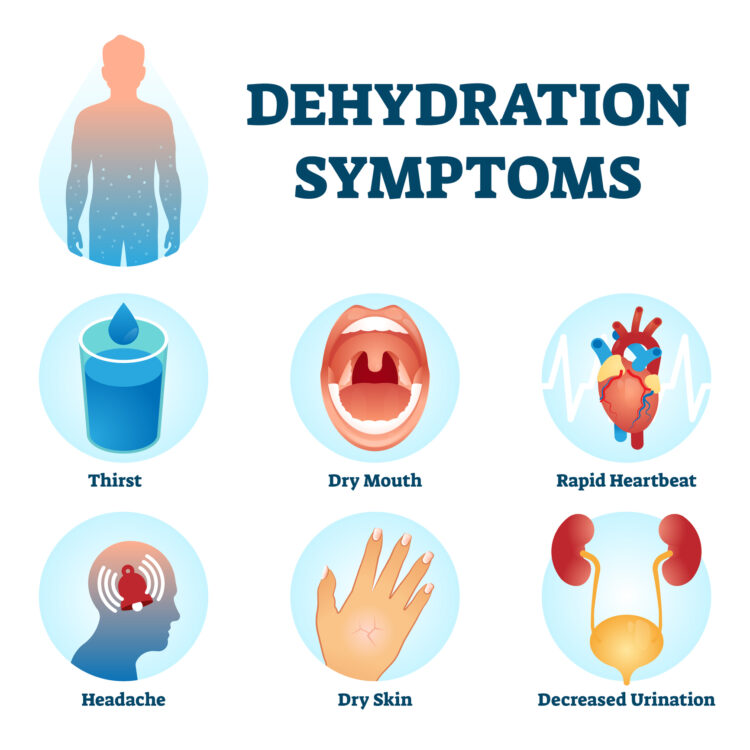 How Long Does A Dehydration Migraine Last?