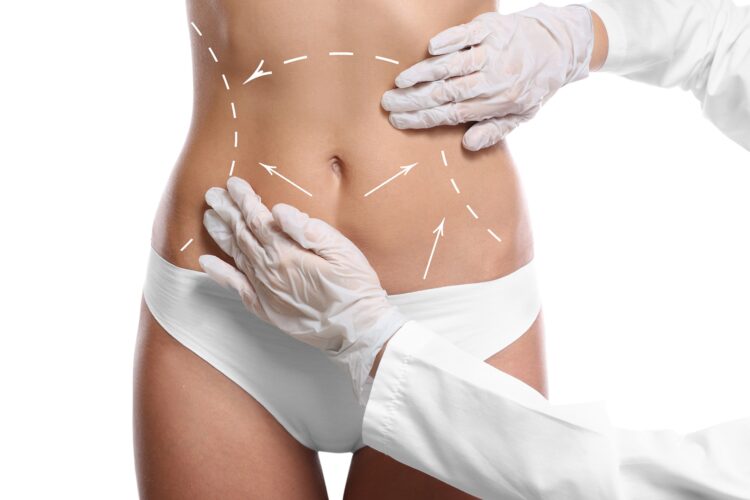 A New You: How Liposculpture in Sydney Can Transform Your Everyday Life